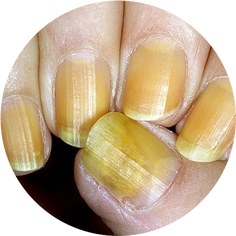 yellow-nails-intensa.pro